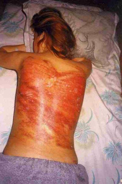 دختر قربانی تجاوز جنسی گروهی