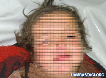 نیلوفر دختر سه ساله تجاوز‌شده