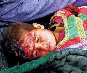 کودک افغان که در اثر بمباردمان امریکایی ها کشته شدند